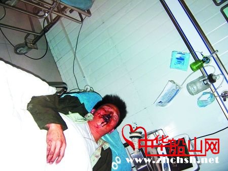 今天没弄死 <wbr> <wbr>就算捡条命啊! 摊贩被城管打掉两门牙 围观市民怒掀执法车(图)